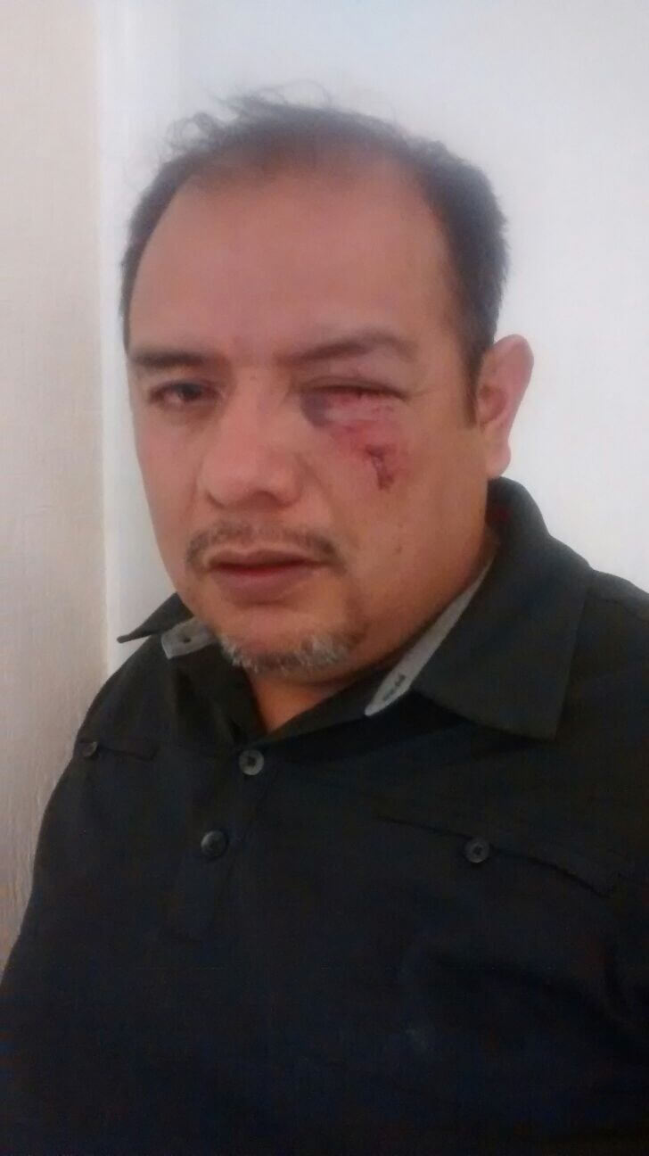 Policías estatales tunden a golpes regidor perredista