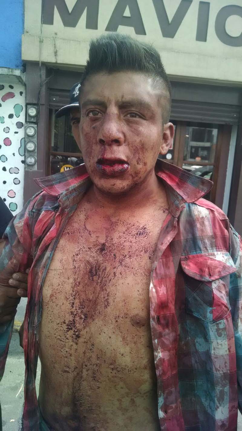 Tunden a golpes a presunto ladrón
