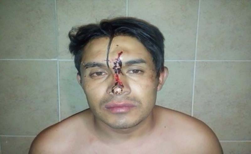 Discusión conyugal terminó a cabezazos contra los cristales