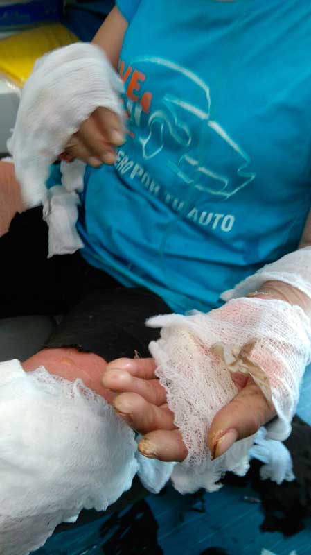 incidente2
