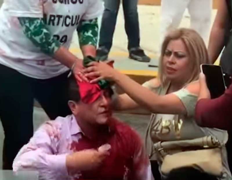 Enfrentamiento en la caseta de cuota de la autopista México-Toluca deja un lesionado