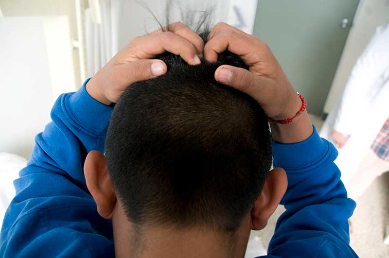 Emiten recomendaciones para evitar parasitos capilares (piojos) en temporada de calor