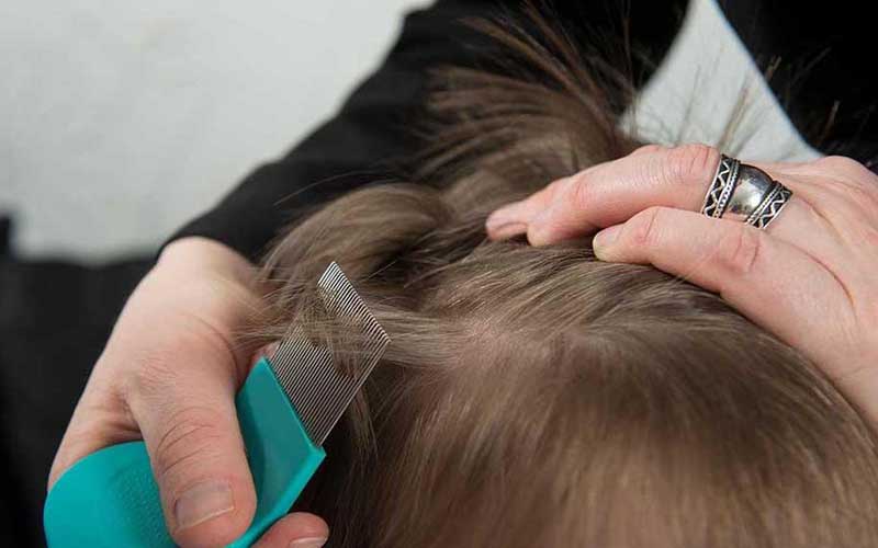 Importante la detección oportuna de pediculosis (piojos) en niños