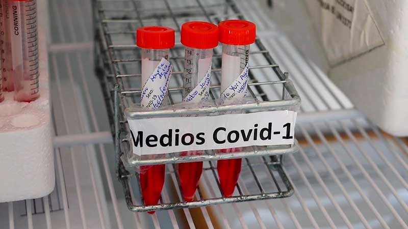 Laboratorio estatal realiza prueba Trioplex para detectar Influenza A,B y Covid-19 en una muestra