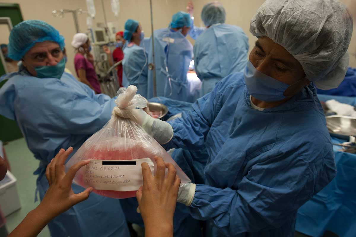 Médicos realizando un trasplante de órganos a un paciente
