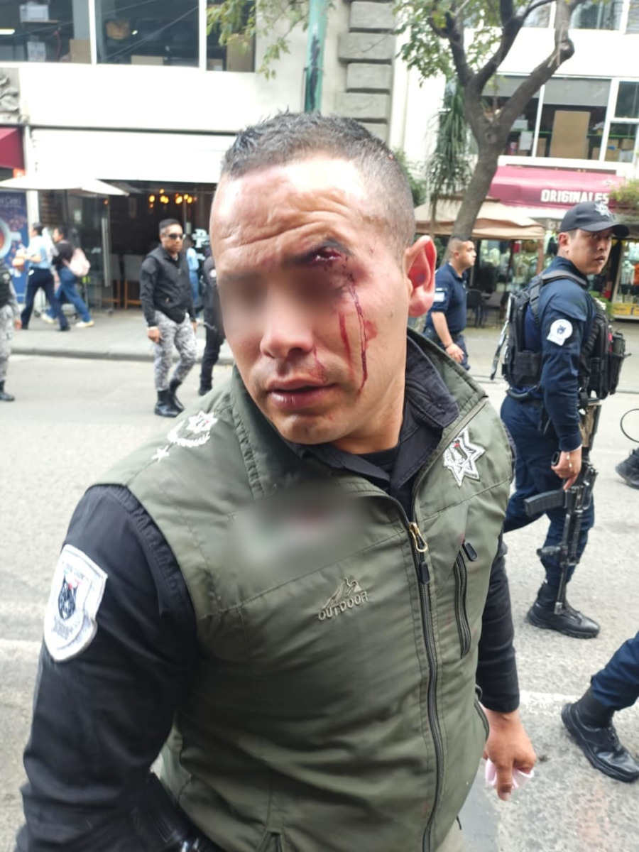 Policía agredido.